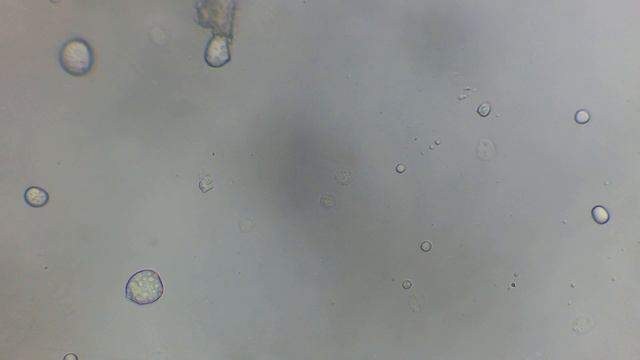 Ichthyobodo necatrix смотреть онлайн