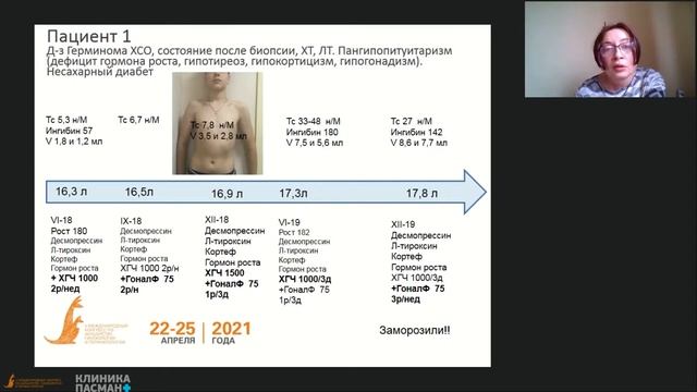 Мазеркина Н.А. Результаты терапии центрального гипогонадизма VМеждународный конгресс 24.04 Зал 2 смотреть онлайн