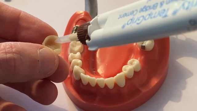 Hey Doc, how much temporary cement should I use, and what type should I use? смотреть онлайн