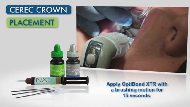 CEREC XTR NX3 смотреть онлайн