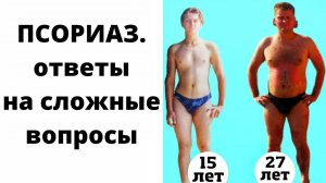 15 ЛЕТ С ПСОРИАЗОМ. История от первого лица