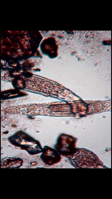 Rotifer Quickshot, Hey you, click on this here video. смотреть онлайн