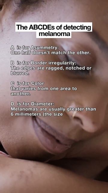 The ABCDEs of Detecting Melanoma! #skincancer #skincare #skincaretips #skincareroutine смотреть онлайн