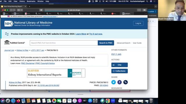 May 27, 2024 Nephrology VMR With Dr. Raad Chowdhury - BL Lower Extremity Edema