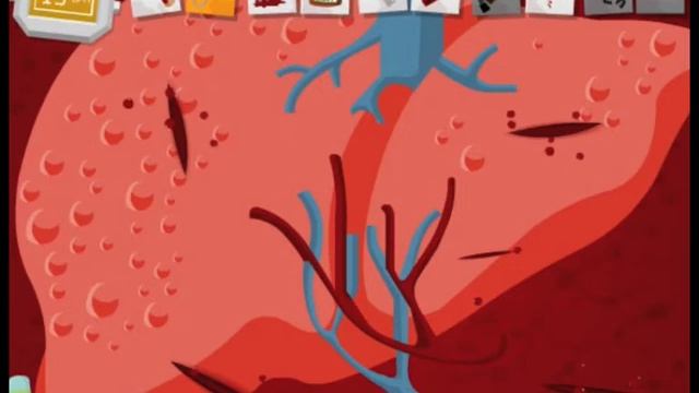 AMATEUR SURGEON #3 - ROADKILL CLETUS смотреть онлайн