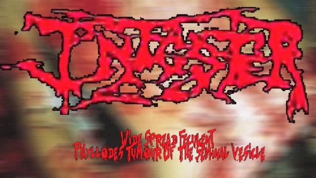 Infester - Wide Spread Feculent Phyllodes Tumour Of The Seminal Vesicle (Full Album) смотреть онлайн