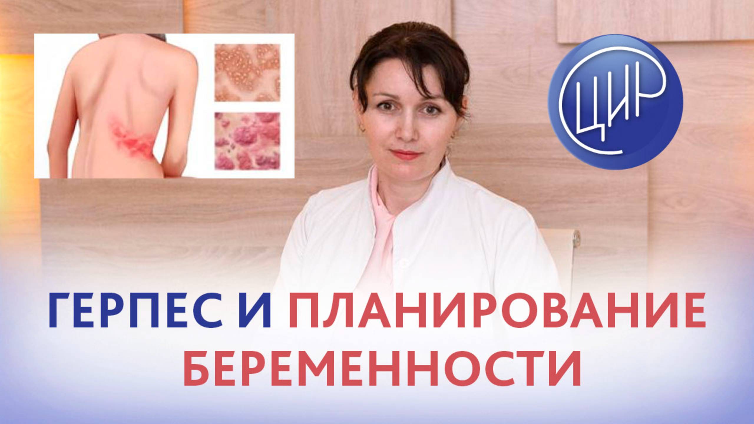 Герпес во время овуляции и планирование беременности. Врач акушер-гинеколог ЦИР, Дюльгер В.П.