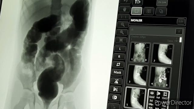 Barium Enema смотреть онлайн