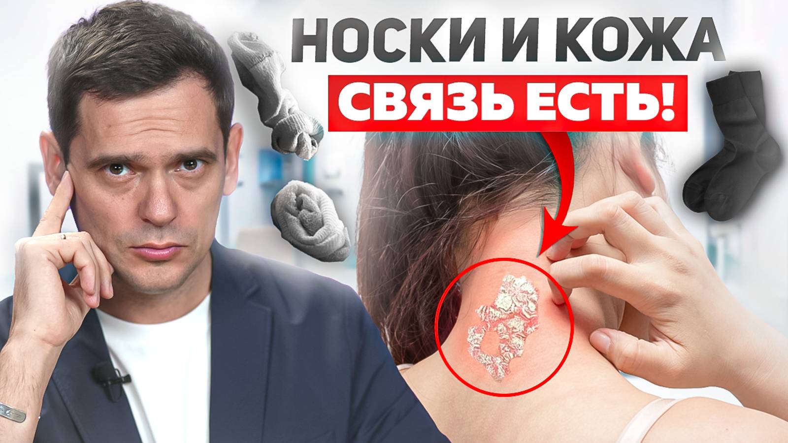 Псориаз НЕ ВРНЕТСЯ! Эти действия помогут забыть про кожные заболевания, дерматиты, экземы смотреть онлайн