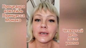 Уколы красоты Четвертый день после процедуры коктейль Принцесса Монако/Отзыв