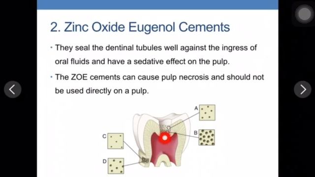 #DM Dentlal cement lecture 5 part1 смотреть онлайн