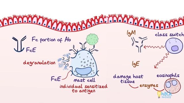 Type I Hypersensitivity - Pathogenesis and Clinical manifestations смотреть онлайн