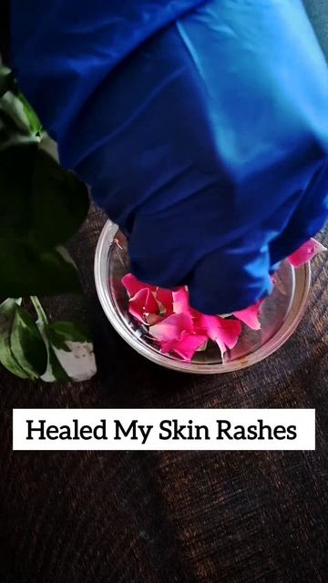 You Won't Believe What Happened When I Started Applying This Aloerose Gel Daily! смотреть онлайн