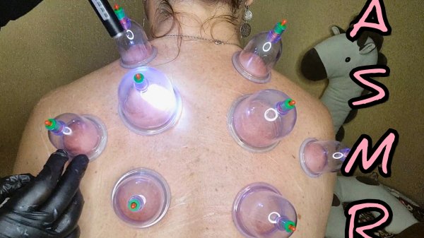 АСМР/Вакуумные баночки