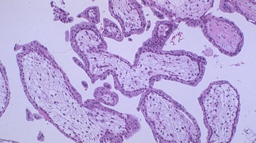 Патологическая анатомия заболеваний беременных смотреть онлайн