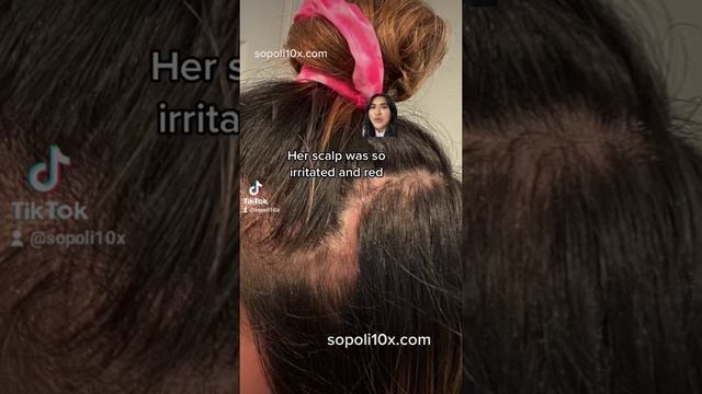Vegamour review www.sopoli10x.com #vegamour #hairlosssolution #haircare смотреть онлайн