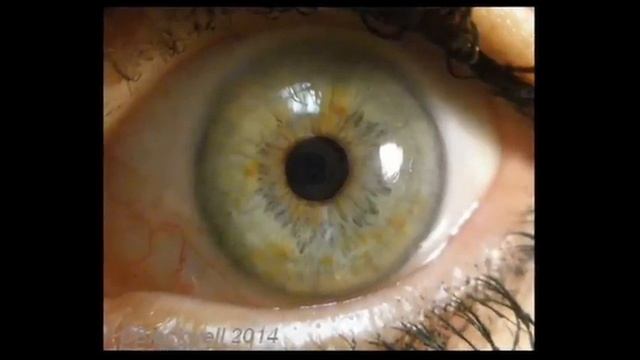 Cornea 1: A Remarkable Structure смотреть онлайн