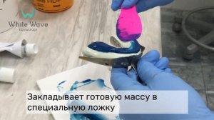 Как делают слепки (оттиски) зубов? Протезирование зубов. Коронка Emax