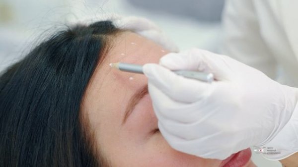 Ботокс (ботулинотерапия)