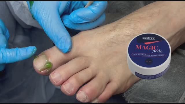 4 способа обработки кутикулы в педикюре. Подология и педикюр смотреть онлайн