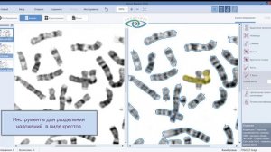 Видеоролик по работе с АРГУС-КАРИО