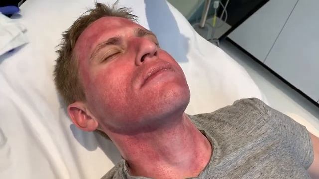 Enzyme Mask | West Hollywood, CA | Dr. Jason Emer смотреть онлайн