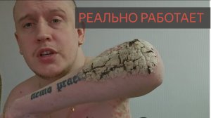 Лекарство от псориаза. Эфлейра