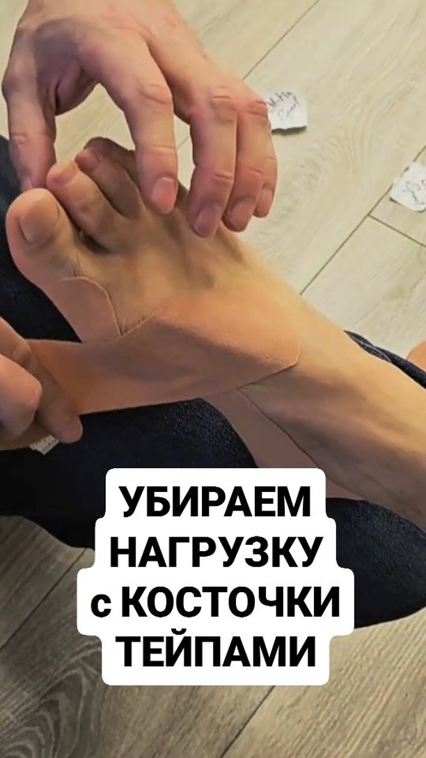 Снижаем НАГРУЗКУ на косточку Тейпами, но чтобы решить причину косточки нужна дополнительно стелька смотреть онлайн
