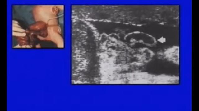 MORFOFISIOLOGIA HUMANA 4 CLASE 11 SEGUNDO AÑO MIC смотреть онлайн