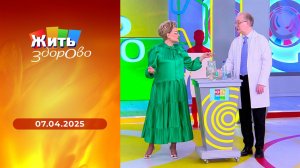Жить здорово! Выпуск от 07.04.2025