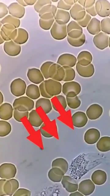Exploring the Fascinating World of Blood Cells: A Microscopic Journey through the Human Body. #shor смотреть онлайн