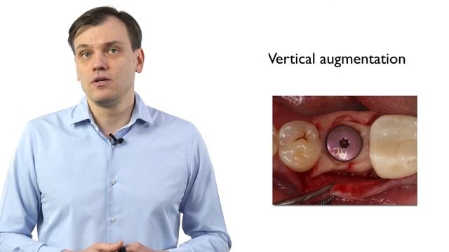 Tomas Linkevicius - 3. Increasing vertical soft tissue thickness. Subcrestal implant placement смотреть онлайн