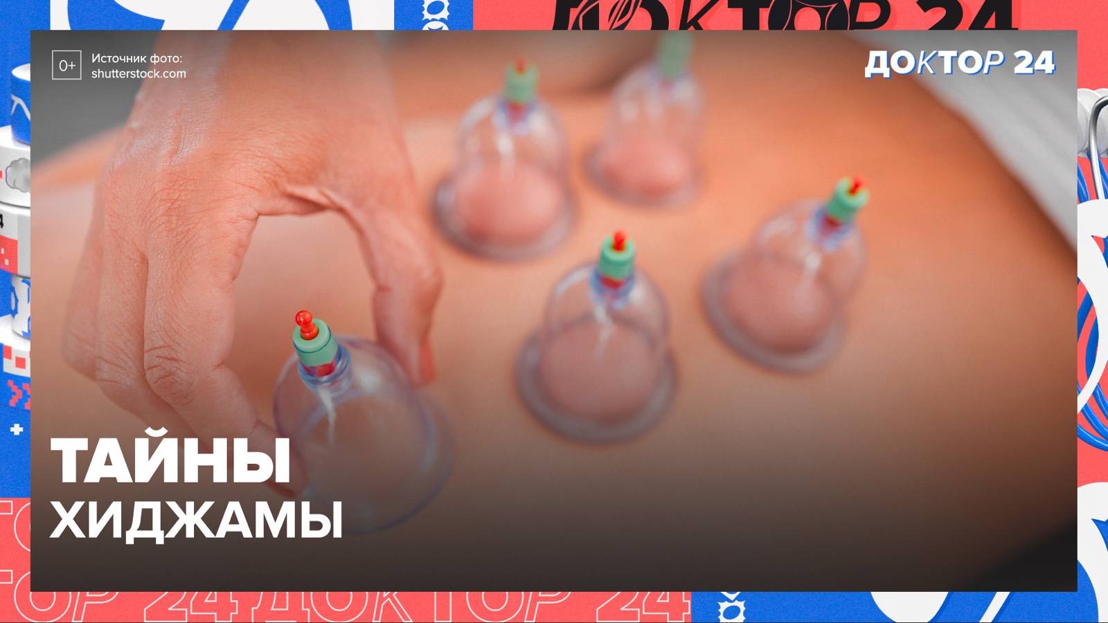 ТАЙНЫ ХИДЖАМЫ | Доктор 24 смотреть онлайн