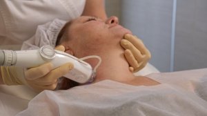 Микроигольчатый RF-лифтинг