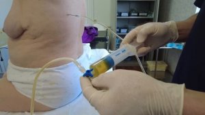 Хирургия для чайников. Плевральная пункция, плевральный дренаж.