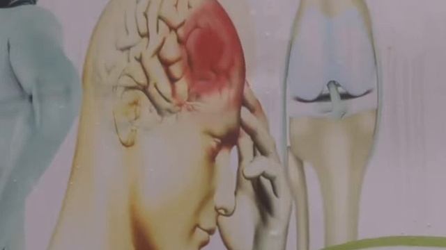 Health Focus: Stroke and how to cope with it смотреть онлайн