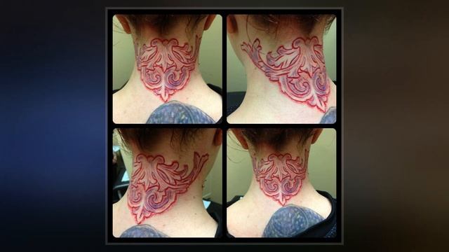Scarification