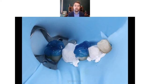 INJECTABLE TECHNIQUE On Distal Teeth - PROTOCOL