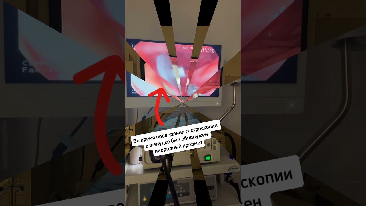 Гастроскопия коту Серафиму #ветеринар #ветклиникакосточка смотреть онлайн