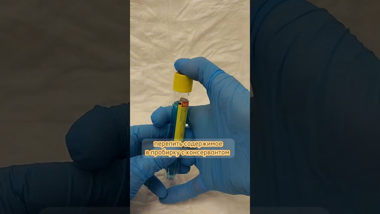 Как собрать мочу собаки на анализ? смотреть онлайн