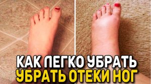 КАК ЛЕГКО УБРАТЬ ОТЕКИ НОГ бабушкиным средством - НАРОДНАЯ МЕДИЦИНА