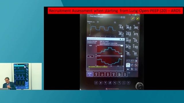 Assessing lung recruitability at the  bedside  Marcelo Amat ISICEM-44 (2025)