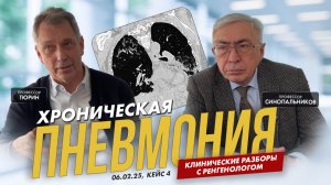 Клинические разборы с рентгенологом. Профессор Тюрин. 06.02.25, кейс 4