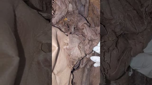 liver pancreas 3 смотреть онлайн
