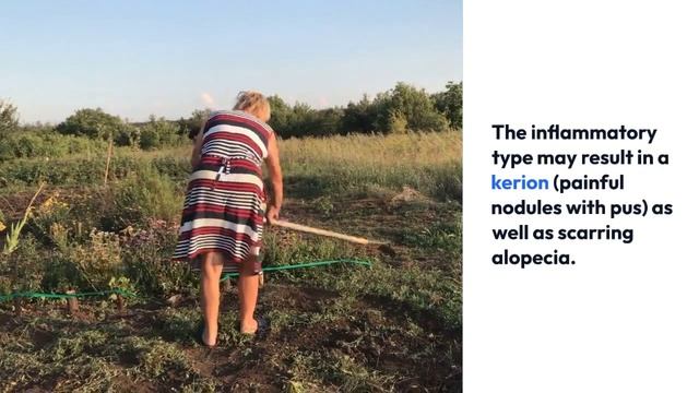 The Tinea Capitis Revolution: Say Goodbye to Hair Loss with This Game-Changing Treatment! смотреть онлайн