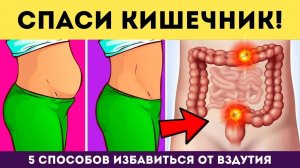 ТОП 3 упражнения от ВЗДУТИЯ ЖИВОТА • СПАСИ КИШЕЧНИК