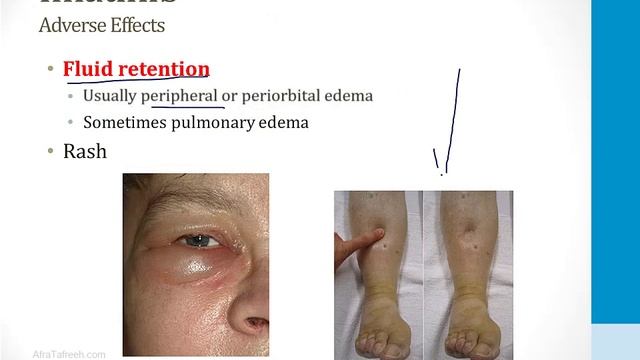 Hematology - 4. Cancer Drugs - 6.Other Cancer Drugs Atf