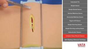 Комплексная техника наложения швов на глубокие раны