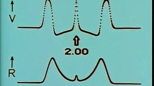Impulse propagation in a nerve fiber 2/3 смотреть онлайн