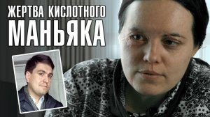 СОСЕД ОБЛИЛ КИСЛОТОЙ | Дело «кислотного маньяка» | ЛИНЗА